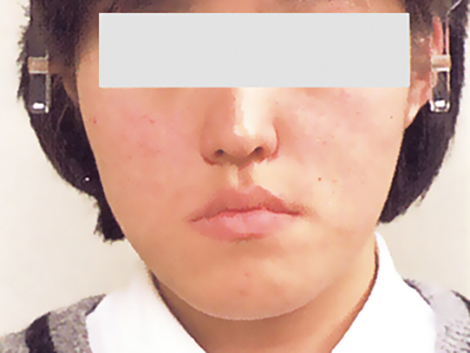 外科治療 治療前 外科治療 治療前